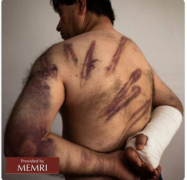 Fotografía de un periodista torturado por los talibanes que fue tuiteada por Zahra Rahimi