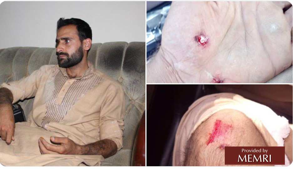 El periodista Imran Falzy fue golpeado y torturado, fotografías tuiteadas por Samiullah Mahdi